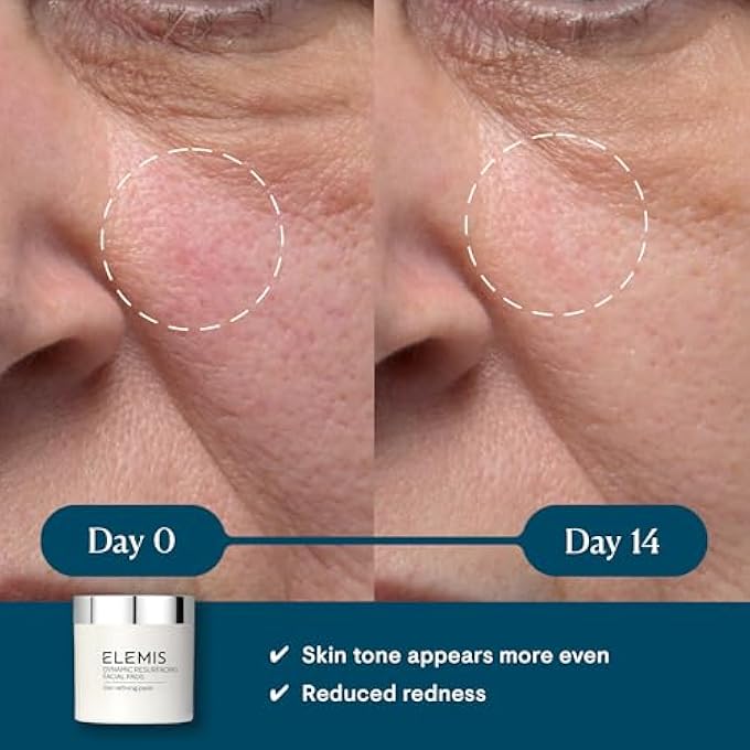 Elemis DYNAMIC RESURFACING FACIAL PADS - Image 2